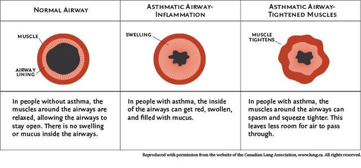 Asthma suffers last fan pic