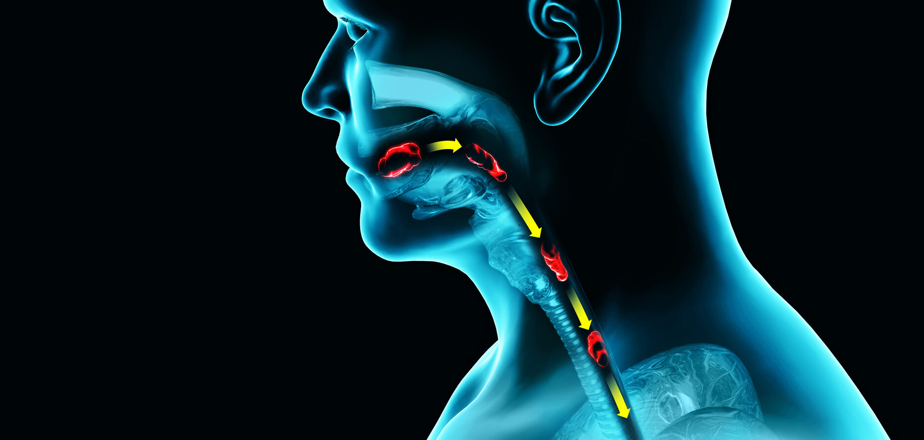 Swallowing diagram